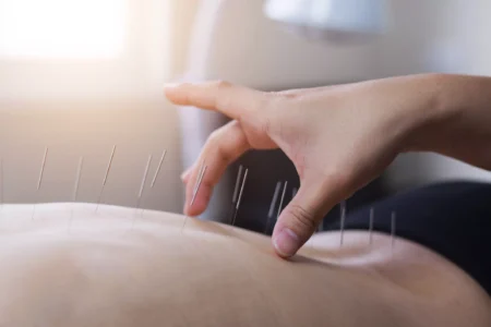 A Holistic Approach to Pain Relief: Acupuncture and Chiropractic Care in Chicago